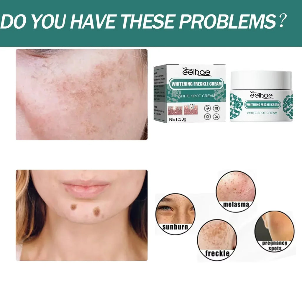 Cream Lighten Dark Skin Chloasma Serum Fade Fine Face Lines