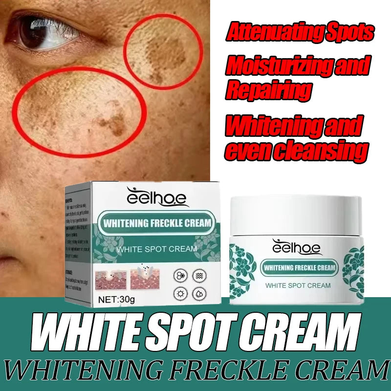 Cream Lighten Dark Skin Chloasma Serum Fade Fine Face Lines
